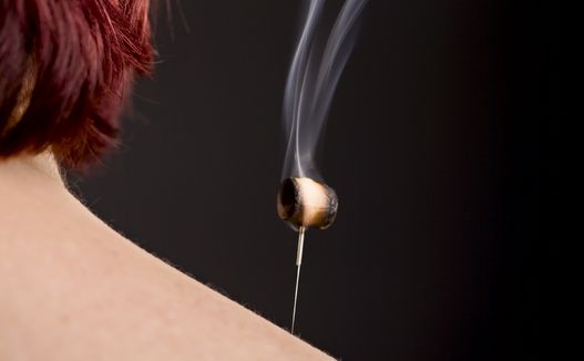 Moxibustion therapy for shoulder pain